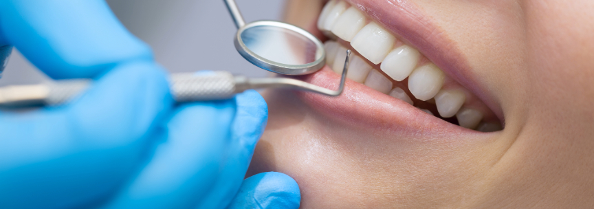 Can You Pass The composite fillings Blue Springs Test?